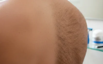 Épilation homme à amiens : Ce qu’il faut savoir avant de venir